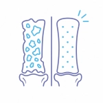 Sụn tái tạo có cấu trúc và đặc tính tương tự sụn tự nhiên của cơ thể